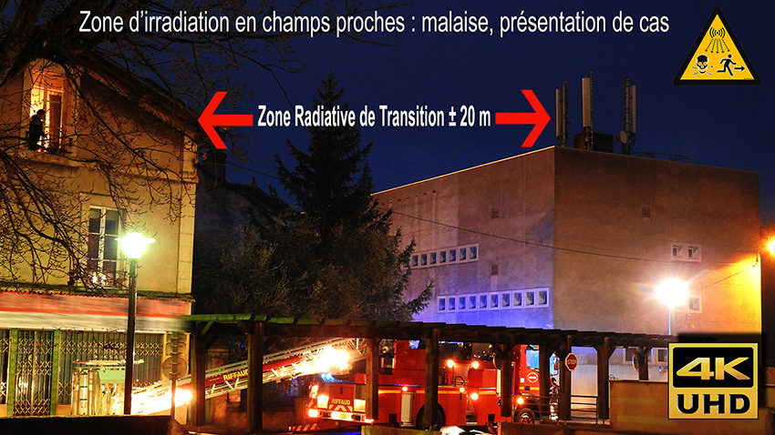 Antennes_relais_presentation_de_cas_malaise_zone_Transition_850_DSCN6850.jpg