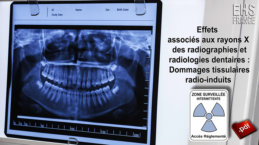 Effets_associes_aux_rayons_X_des_radiographies_et_radiologies_dentaires_panoramamique_cone_beam_850.jpg