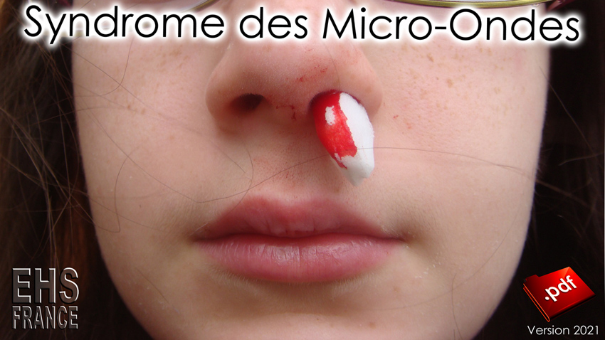 Syndrome_des_Micro_ondes_v2021_850_DSC08216.jpg